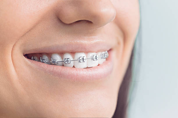 Best Full Mouth Reconstruction  in Charlack, MO